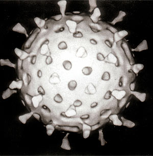 virus